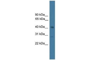 Western Blotting (WB) image for anti-serpin Peptidase Inhibitor, Clade B (Ovalbumin), Member 7 (SERPINB7) (N-Term) antibody (ABIN2787991)