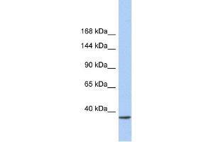 Western Blotting (WB) image for anti-SWI/SNF-Related, Matrix-Associated Actin-Dependent Regulator of Chromatin, Subfamily A, Containing DEAD/H Box 1 (SMARCAD1) (N-Term) antibody (ABIN2775854)