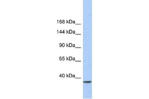 WB Suggested Anti-SMARCAD1 Antibody Titration:  0. (SMARCAD1 Antikörper  (N-Term))