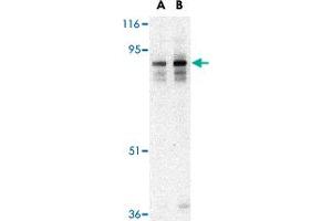 Western blot analysis of LIPE in human lymph node tissue lysate with LIPE polyclonal antibody  at (A) 0. (LIPE Antikörper  (C-Term))