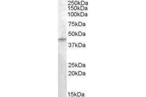 Western Blotting (WB) image for Ras Association (RalGDS/AF-6) Domain Family (N-terminal) Member 8 (RASSF8) peptide (ABIN369749) (Ras Association (RalGDS/AF-6) Domain Family (N-terminal) Member 8 (RASSF8) Peptid)