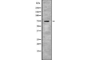 Western blot analysis SLC24A2 using COLO205 whole cell lysates (SLC24A2 Antikörper  (Internal Region))