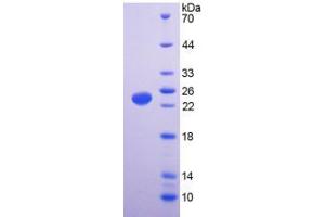 SDS-PAGE analysis of Human TRPV1 Protein. (TRPV1 Protein)