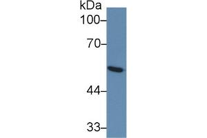 Detection of GLUT1 in Human Serum using Monoclonal Antibody to Glucose Transporter 1 (GLUT1) (GLUT1 Antikörper  (AA 251-329))