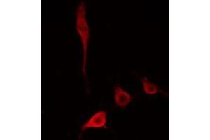 ABIN6274779 staining HepG2 cells by IF/ICC. (RPL34 Antikörper)