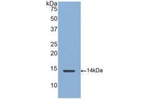 Detection of Recombinant CTGF, Human using Polyclonal Antibody to Connective Tissue Growth Factor (CTGF) (CTGF Antikörper  (AA 248-349))