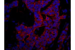 anti-Ubiquitin Protein Ligase E3 Component N-Recognin 4 (UBR4) (AA 5133-5183) antibody