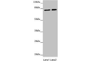 Western blot All lanes: DHX33 antibody at 16 μg/mL Lane 1: Hela whole cell lysate Lane 2: 293T whole cell lysate Secondary Goat polyclonal to rabbit IgG at 1/10000 dilution Predicted band size: 79, 61 kDa Observed band size: 79 kDa (DHX33 Antikörper  (AA 116-357))