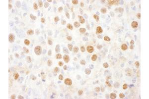 anti-Proteasome (Prosome, Macropain) 26S Subunit, Non-ATPase, 2 (PSMD2) (AA 50-100) antibody