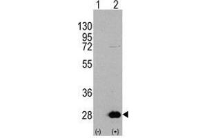 Western blot analysis of HSPB1 (arrow) using rabbit polyclonal HSPB1 Antibody 293 cell lysates (2 µg/lane) either nontransfected (Lane 1) or transiently transfected with the HSPB1 gene (Lane 2) (HSP27 Antikörper  (Ser78))