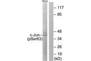 Western blot analysis of extracts from HeLa cells treated with UV, using c-Jun (Phospho-Ser63) Antibody. (C-JUN Antikörper  (AA 31-80))
