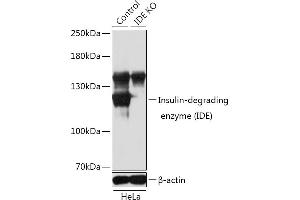 Western blot analysis of extracts from normal (control) and Insulin-degrading enzyme (Insulin-degrading enzyme (IDE)) knockout (KO) HeLa cells, using Insulin-degrading enzyme (Insulin-degrading enzyme (IDE)) antibody (ABIN3022284, ABIN3022285, ABIN3022286 and ABIN1513057) at 1:1000 dilution. (IDE Antikörper  (AA 1-250))