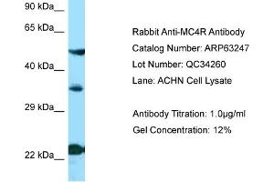 Western Blotting (WB) image for anti-Melanocortin 4 Receptor (MC4R) (N-Term) antibody (ABIN2789422) (MC4R Antikörper  (N-Term))