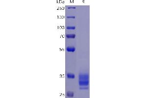 Human EPCAM Protein, His Tag on SDS-PAGE under reducing condition.