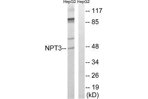 Western blot analysis of extracts from HepG2 cells, using SLC17A2 antibody. (SLC17A2 Antikörper  (Internal Region))