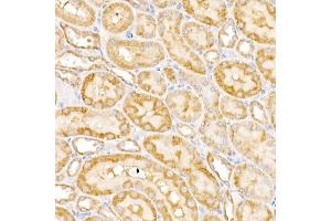 Immunohistochemistry of paraffin-embedded rat kidney using G Rabbit pAb (ABIN6133219, ABIN6140940, ABIN6140941 and ABIN6222644) at dilution of 1:450 (40x lens). (GALNT2 Antikörper  (AA 442-571))