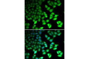 Immunofluorescence analysis of U2OS cells using KDM4B antibody (ABIN5973438). (KDM4B Antikörper)