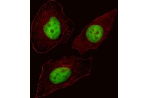 Fluorescent image of Hela cell stained with FOXN3 Antibody (C-term) (ABIN1537230 and ABIN2838260).
