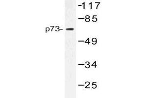 Western blot (WB) analysis of p73 antibody in extracts from Jurkat cells. (Tumor Protein p73 Antikörper)