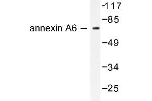 Image no. 1 for anti-Annexin A6 (ANXA6) antibody (ABIN265310) (ANXA6 Antikörper)