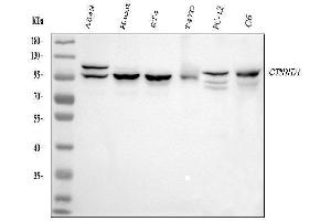 Western blot analysis of CTNND1 using anti-CTNND1 antibody (ABIN7602220). (CTNND1 Antikörper  (AA 64-930))