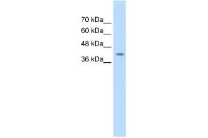WB Suggested Anti-SERPINB5 Antibody Titration:  0. (SERPINB5 Antikörper  (Middle Region))