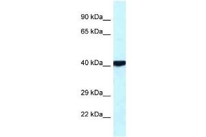 PRKACB antibody used at 1 ug/ml to detect target protein. (PRKACB Antikörper  (Middle Region))