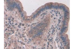 DAB staining on IHC-P; Samples: Mouse Liver Tissue (SNX18 Antikörper  (AA 411-614))