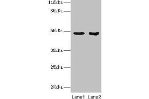 Western blot All lanes: SKP2 antibody at 2 μg/mL Lane 1: Jurkat whole cell lysate Lane 2: Hela whole cell lysate Secondary Goat polyclonal to rabbit IgG at 1/10000 dilution Predicted band size: 48, 47, 24 kDa Observed band size: 48 kDa (SKP2 Antikörper  (AA 1-424))