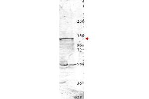 Image no. 1 for anti-Neural Precursor Cell Expressed, Developmentally Down-Regulated 4, E3 Ubiquitin Protein Ligase (NEDD4) (Internal Region) antibody (ABIN401453) (NEDD4 Antikörper  (Internal Region))