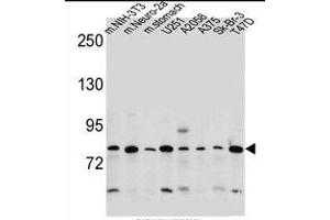 DCBLD2 Antibody (C-term) (ABIN657748 and ABIN2846732) western blot analysis in mouse NIH-3T3,Neuro-2a cell line and mouse stomach tissue and ,,,Sk-Br-3,T47D cell line lysates (35 μg/lane).