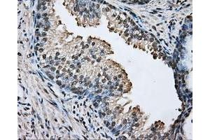 Immunohistochemical staining of paraffin-embedded prostate tissue using anti-ARNT mouse monoclonal antibody. (ARNT Antikörper)
