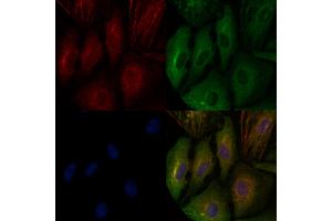 ABIN6260784 and ABIN6276639 staining  cells by IF/ICC. (CGA Antikörper  (Internal Region))