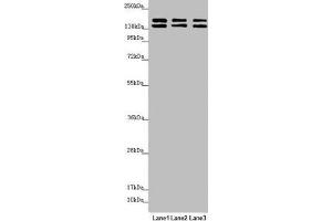 Western blot All lanes: UACA antibody at 5. (UACA Antikörper  (AA 1-90))