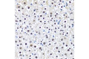 Immunohistochemistry of paraffin-embedded mouse liver using CCAR2 antibody (ABIN2563550) at dilution of 1:100 (40x lens). (CCAR2 Antikörper)