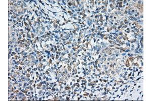 Immunohistochemical staining of paraffin-embedded Human Kidney tissue using anti-TTC32 mouse monoclonal antibody. (TTC32 Antikörper)