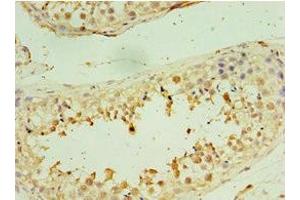 Immunohistochemistry of paraffin-embedded human testis tissue using ABIN7171228 at dilution of 1:100 (Syntaxin 16 Antikörper  (AA 1-300))