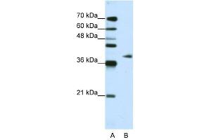 ADAT1 antibody used at 1. (ADAT1 Antikörper  (C-Term))