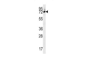 SIX5 Antibody (Center) (ABIN656668 and ABIN2845908) western blot analysis in MDA-M cell line lysates (35 μg/lane). (Six5 Antikörper  (AA 257-286))