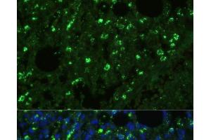 Immunofluorescence analysis of Mouse lung cells using TREM2 Polyclonal Antibody at dilution of 1:100. (TREM2 Antikörper)