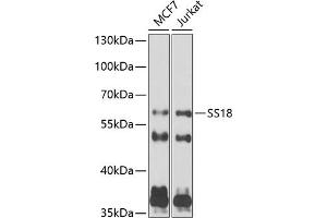 Western blot analysis of extracts of various cell lines, using SS18 antibody (ABIN6133185, ABIN6148473, ABIN6148474 and ABIN6222754) at 1:1000 dilution. (SS18 Antikörper  (AA 1-240))