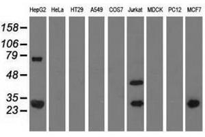 Image no. 2 for anti-Quinolinate Phosphoribosyltransferase (QPRT) antibody (ABIN1500534)