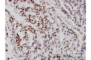 Immunostaining (ISt) image for anti-Neuronal Differentiation 1 (NEUROD1) (AA 201-300) antibody (ABIN561963)