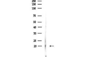 anti-Mid1-Interacting Protein 1 (m1ip1) (Internal Region) antibody