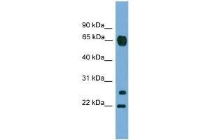 WB Suggested Anti-MMP26  Antibody Titration: 0. (MMP26 Antikörper  (C-Term))