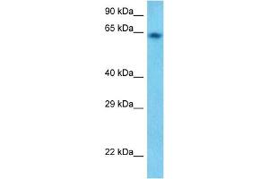Host:  Rabbit  Target Name:  GUCY1B3  Sample Tissue:  Human HepG2 Whole cell  Antibody Dilution:  1ug/ml (GUCY1B3 Antikörper)