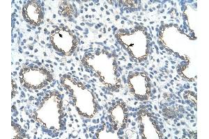 UBE2J1 antibody was used for immunohistochemistry at a concentration of 4-8 ug/ml to stain Alveolar cells (arrows) in Human Lung. (UBE2J1 Antikörper)