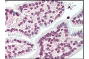Immunohistochemistry (IHC) image for anti-X-Box Binding Protein 1 (XBP1) (AA 2-160) antibody (ABIN492538) (XBP1 Antikörper  (AA 2-160))