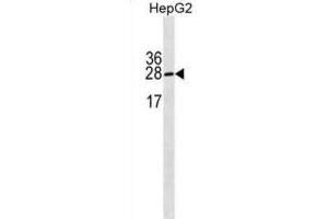 Western Blotting (WB) image for anti-Immunoglobulin lambda-Like Polypeptide 5 (IGLL5) antibody (ABIN3000244) (IGLL5 Antikörper)