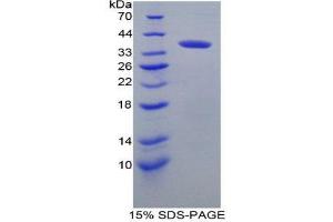 SDS-PAGE (SDS) image for Interferon Regulatory Factor 6 (IRF6) (AA 150-445) protein (His tag) (ABIN2125413)